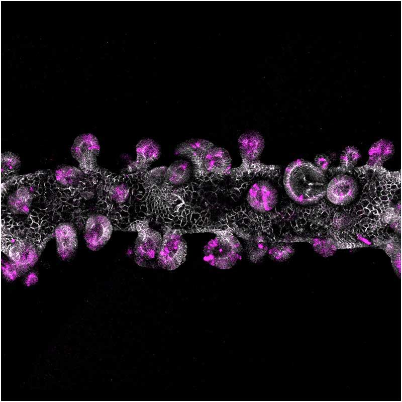 UCSF ve Biohub Bilim İnsanları Daha Tutarlı Laboratuvar Organları Yetiştirmek İçin Yeni Bir Malzeme Geliştirdi